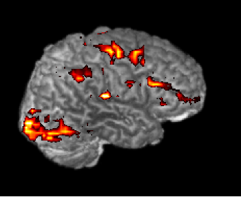 computer render of fMRI data of a human brain