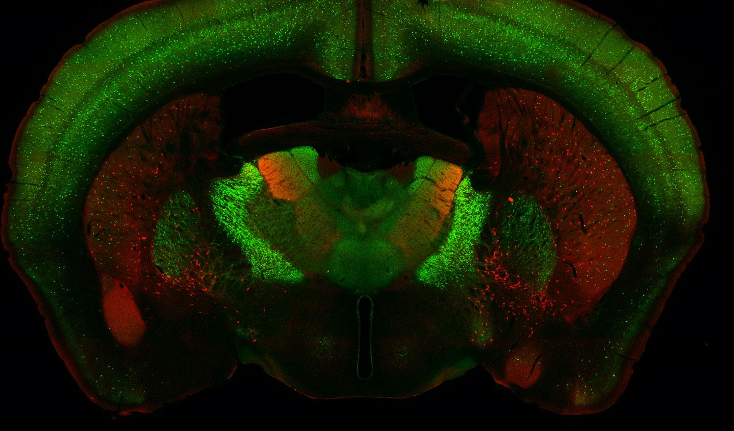 red and green immunofluorescence image of mouse brain section